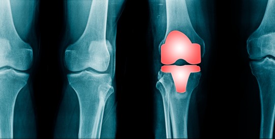 Hätten Sie´s gewußt?